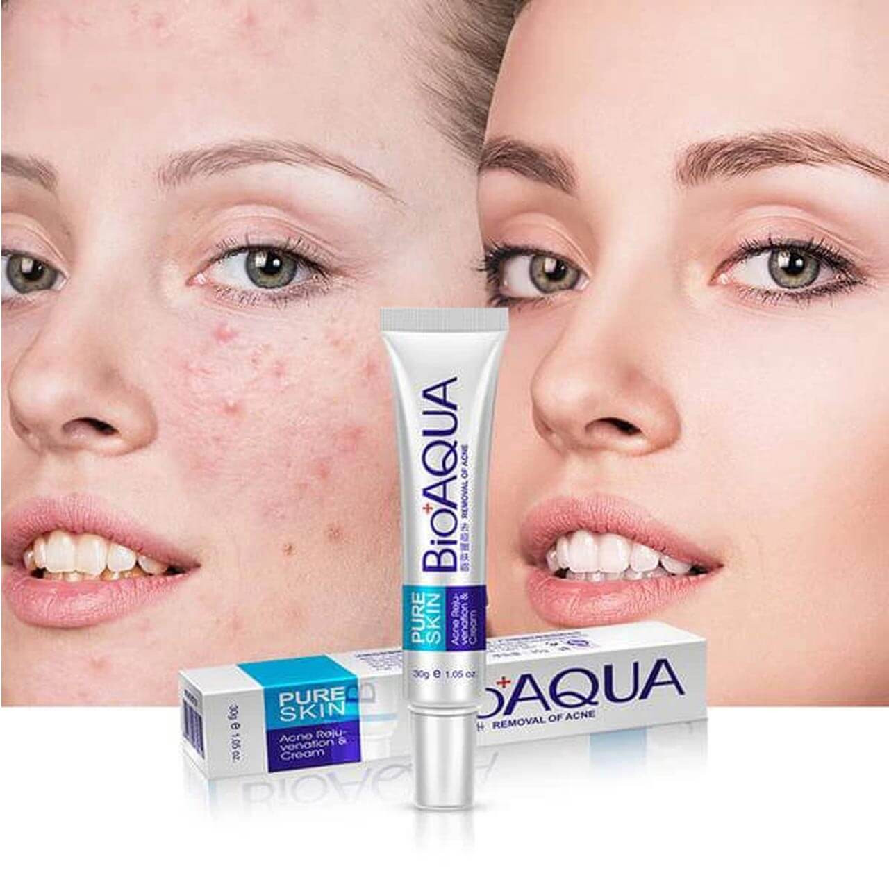 Bioaqua Pure Skin Acne Removal and Rejuvenation Cream 30 gm