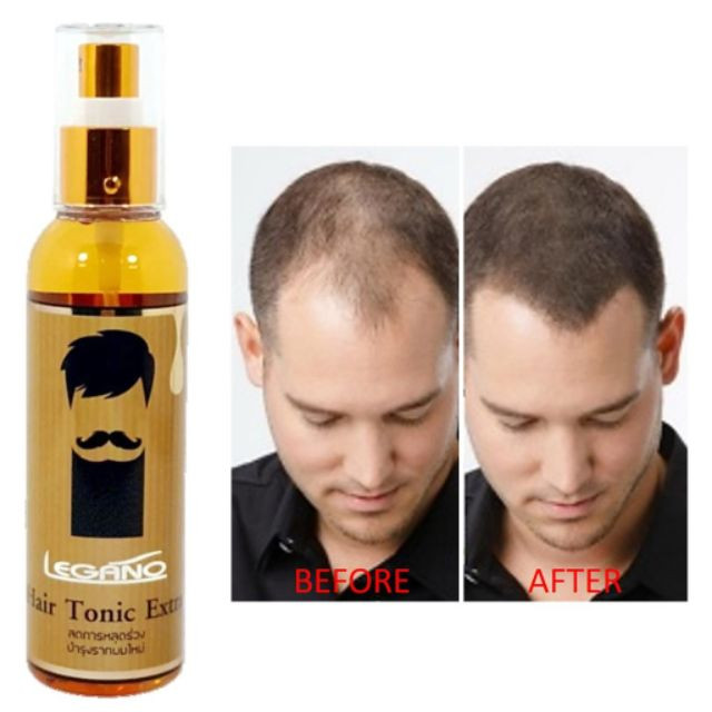 Legano Hair Tonic Extract 120 ml