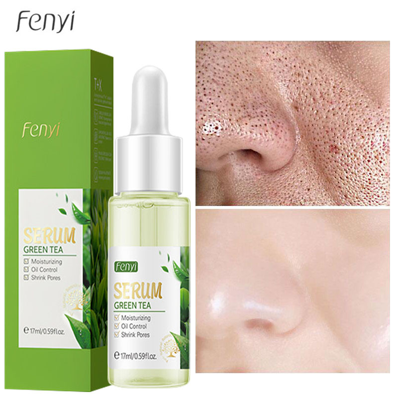 Fenyi Green Tea Facial Serum Sodium Hyaluronic Acid Shrink Pore Moisturizing Oil Control Soothing Acne Skin -17ml