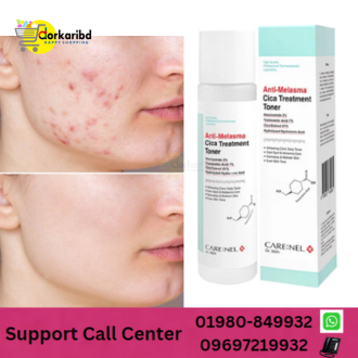 Care:Nel Anti Melasma Cica Treatment Toner -155ml